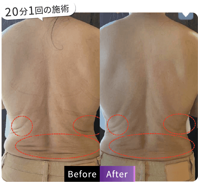 20分1回の施術
